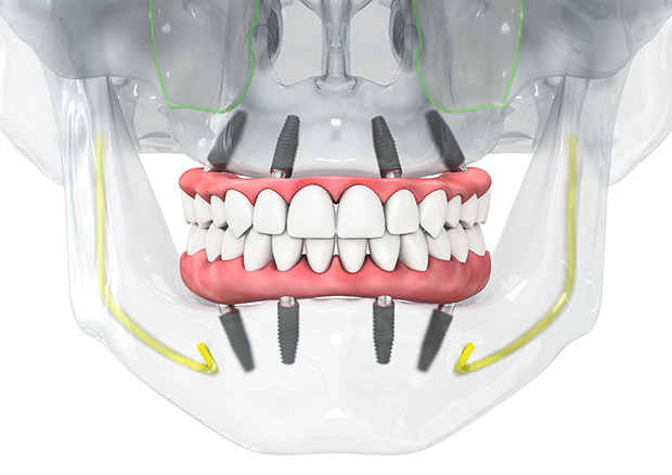 精密な治療をサポートする口腔内スキャナー「iTero(アイテロ)」