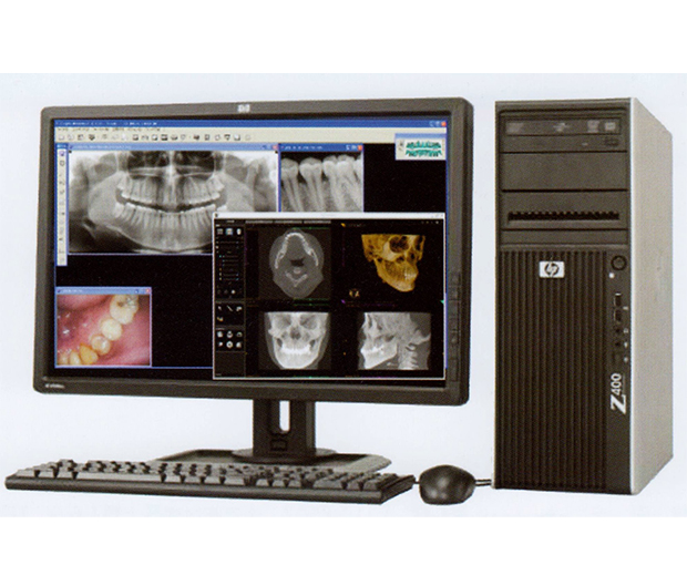 高精度3D診断で、安心の歯科治療を