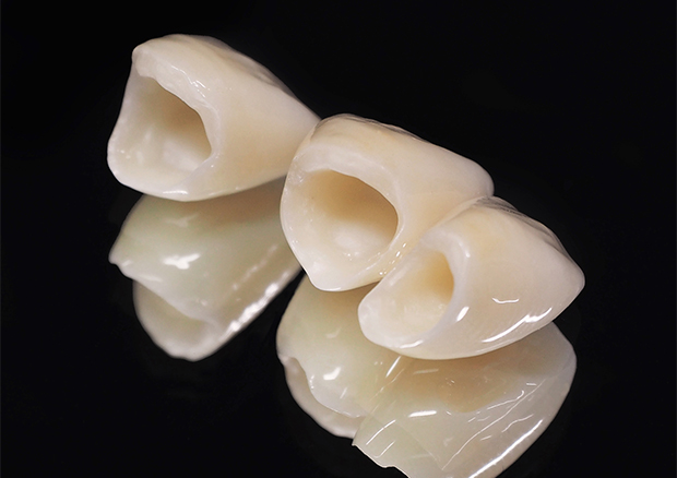 セラミック治療について